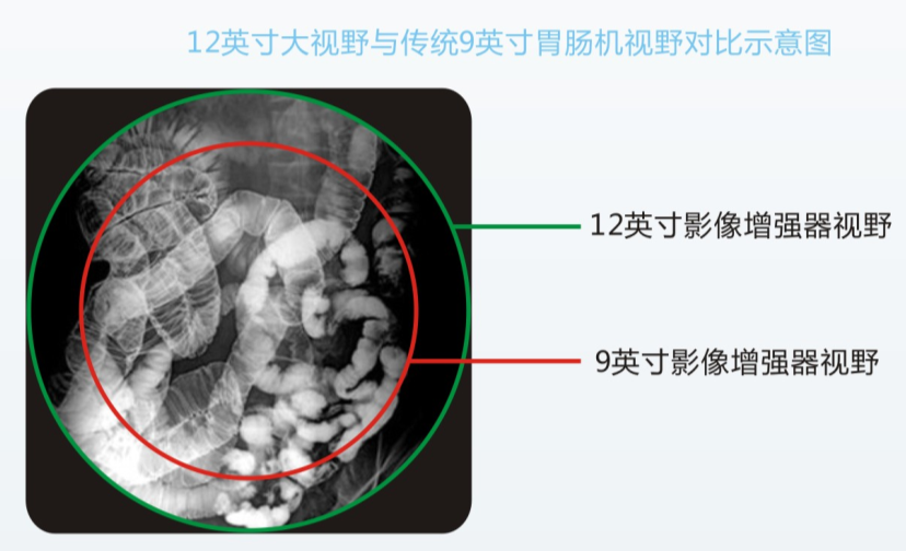 數(shù)字胃腸機(jī)優(yōu)勢(shì)與檢查效果