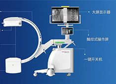 C型臂X射線機(jī)的重要參數(shù)有哪些