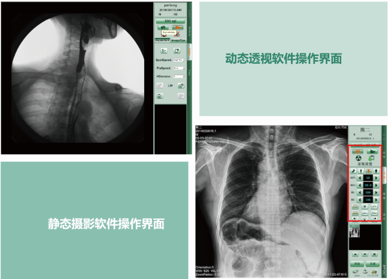 PLD8900動態DR 動靜態一體化軟件