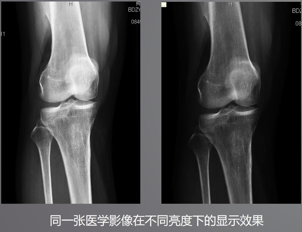 寵物DR設(shè)備的顯示器有要求？普通和醫(yī)用顯示器有什么區(qū)別