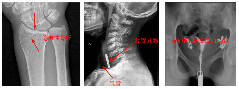 動(dòng)態(tài)DR機(jī)準(zhǔn)確點(diǎn)片