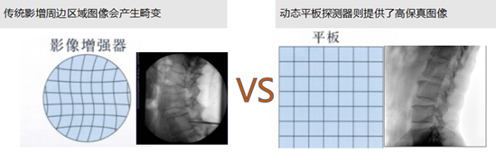 平板C臂